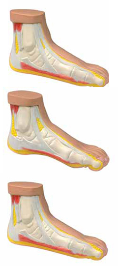 Normal and Abnormal Foot